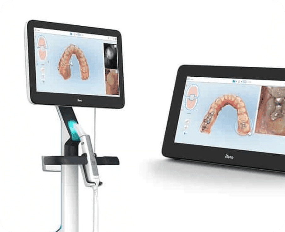 Máy Scan iTero 5D