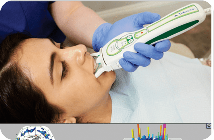 Máy phân tích khớp cắn T-Scan